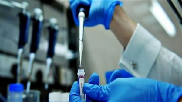 :  الطب الشرعي  يكشف حالات استخدام تحليل الـ DNA